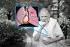 Asins receklis plaušu artērijā: nepalaid garām pirmās pazīmes