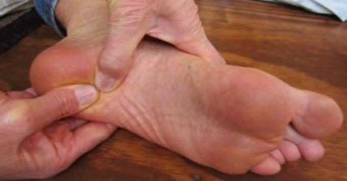 Heel sāpes - sāpes papēžiem