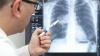 Ārsts salīdzina radiācijas iedarbību ar plaušu CT ar starojumu Hirosimā