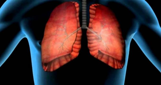 plaušu vēzis