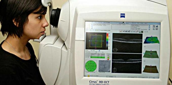 Optiskās koherences tomogrāfija angiogrāfija