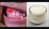 Kā novērst zobu bojāšanos un stiprina imūnsistēmu